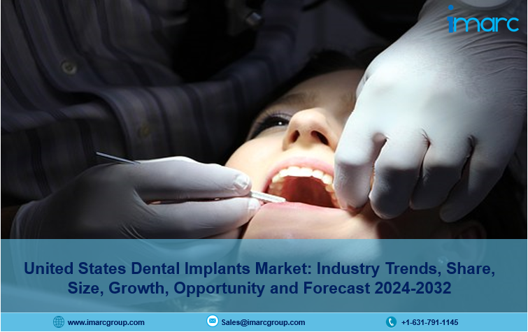 United States Dental Implants Market